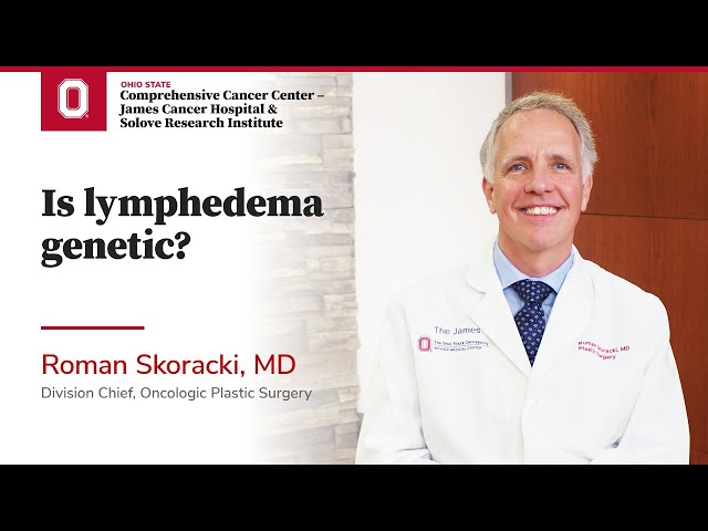 Is lymphedema genetic? | OSUCCC – James