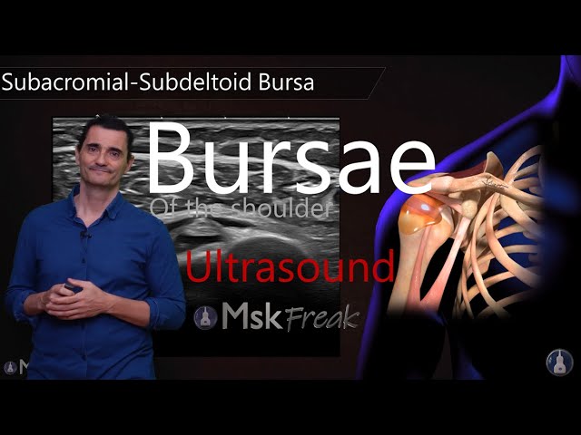 ULTRASOUND OF THE BURSAE OF THE SHOULDER (PART II)