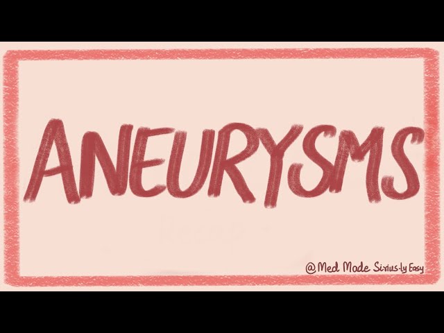 Aneurysms- Types- Pathophysiology- Etiology- Investigations-Treatments