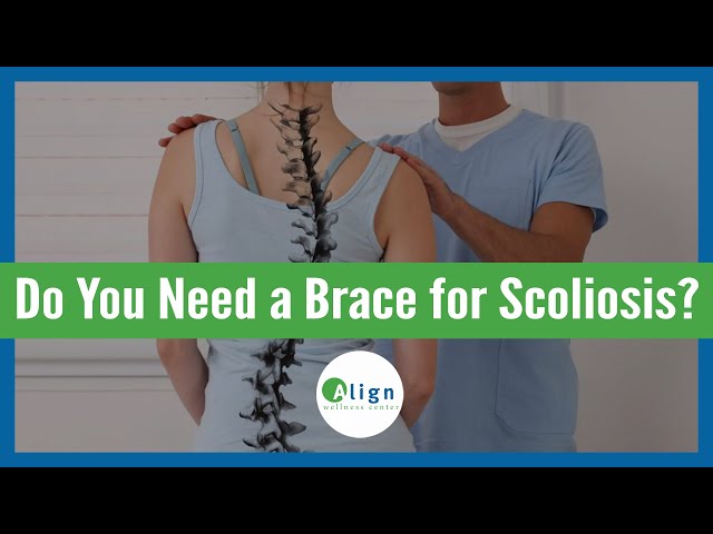 Do You Need Bracing for Scoliosis?