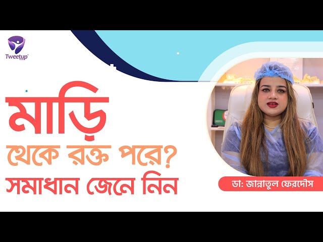 মাড়ি থেকে রক্ত কেন পরে ? সমাধান কি ? দেখুন ভিডিওতে। (4k)