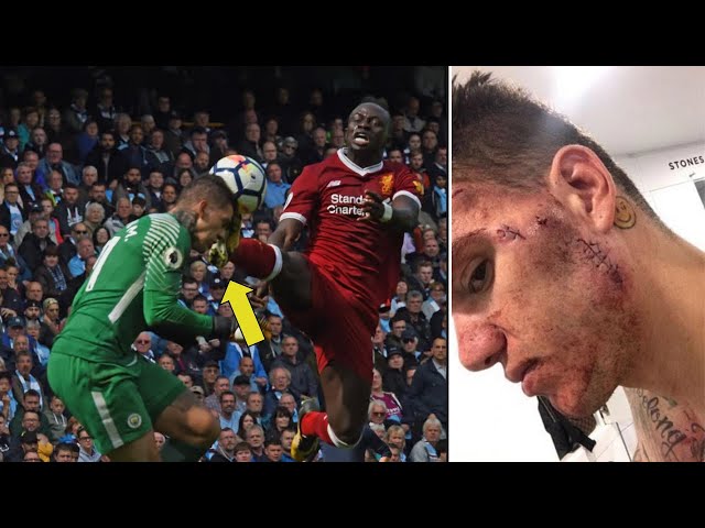 15 Most Brutal Fouls in Football History ⚠️ | Shocking Tackles That Went TOO FAR! #football #tackle