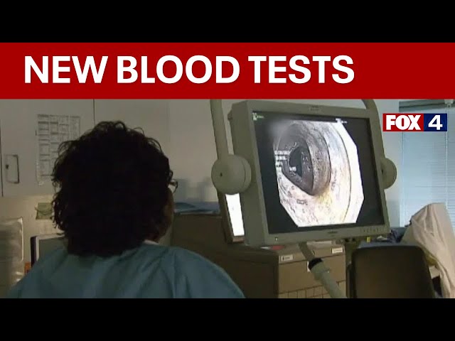 New blood test helps Texas doctors detect colon cancer in patients earlier