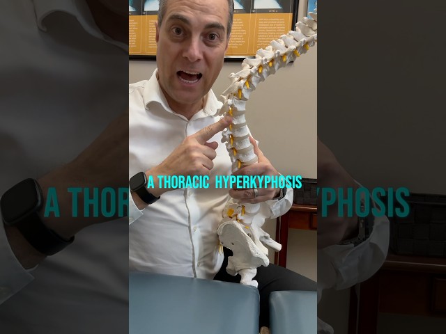 Thoracic Hyperkyphosis FIX with Home Traction | Dr. Walter Salubro Chiropractor in Vaughan, ON