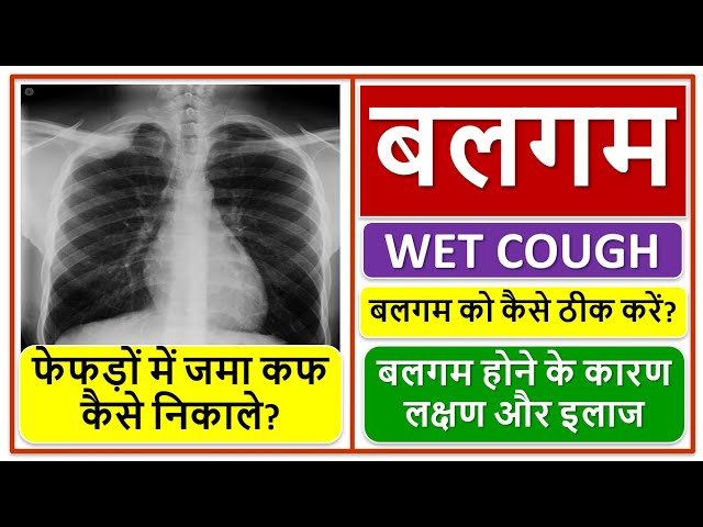 बलगम होने के कारण लक्षण और इलाज, फेफड़ों में जमा कफ कैसे निकाले?, बलगम को कैसे ठीक करें? WET COUGH,