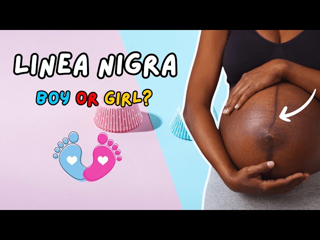 Pregnancy Belly Line | Can the Linea Nigra Predict Your Baby's Gender | Boy or Girl Gender