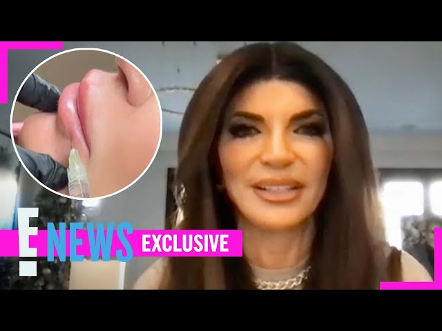 The Real Reason RHONJ’s Teresa Giudice Dissolved Her Lip Fillers (Exclusive) | E! News