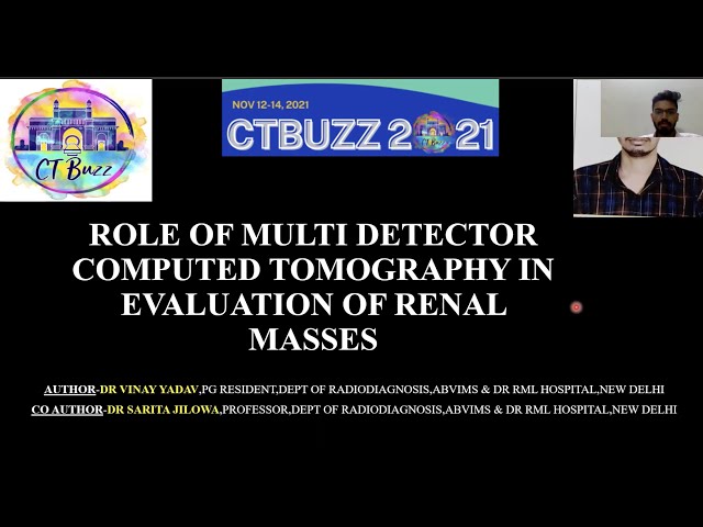 VINAY YADAV || ROLE OF MDCT IN CHARACTERISATION OF RENAL MASSES