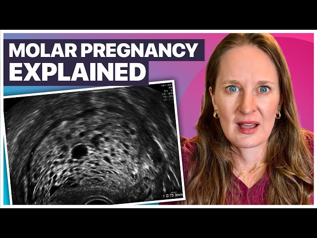 Molar Pregnancy: The Rare Pregnancy Complication Explained