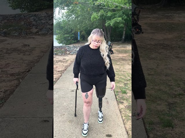 #foryou #physiotherapy #amputee #left #disability #newvideo #new #chattahoochee #georgia