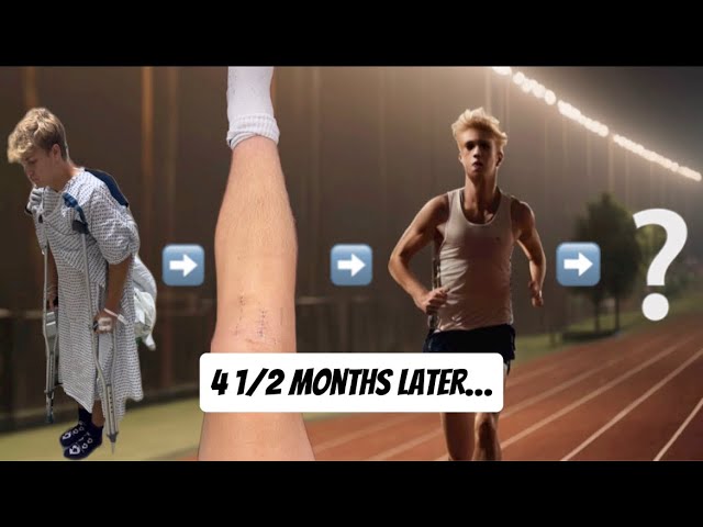 I Tried Running 4.5 Months Post ACL Surgery...