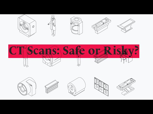 👉 CT Scans & Radiation: Should You Be Worried?