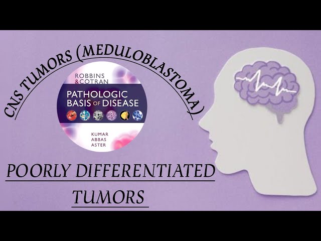 CNS TUMORS PATHOLOGY (PART-8) MEDULLOBLASTOMA |ROBBINS BASIS|