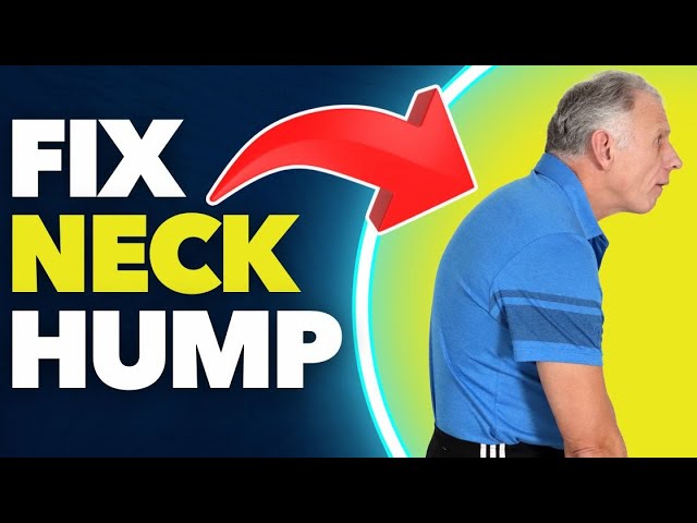 How to Eliminate Neck Hump or Hunchback with a Sock. Bob’s Secrets