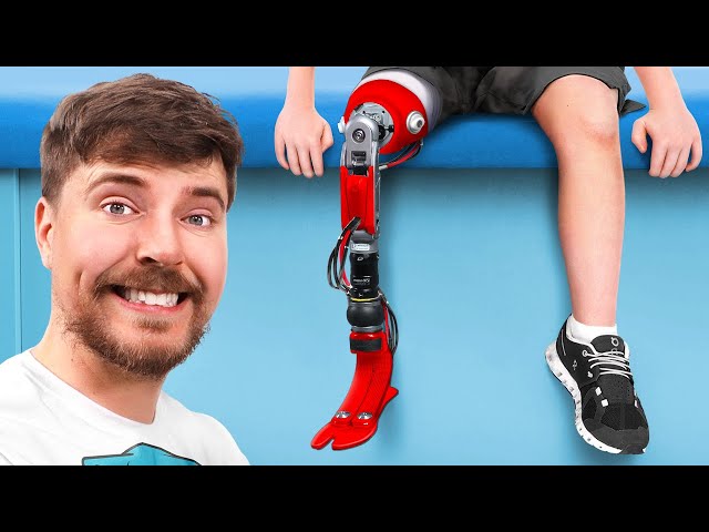 We Helped 2000 People Get New Legs