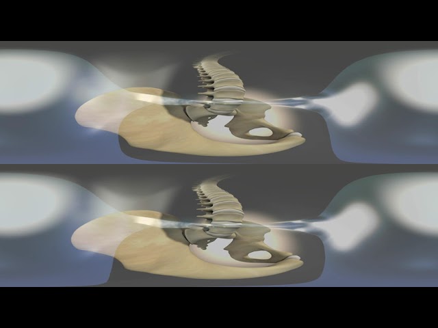 Axial Spondyloarthritis - The IL-17 Pathway in Spondyloarthritis - VR360