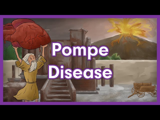 Pompe Disease | Glycogen Storage Disease Mnemonic for USMLE