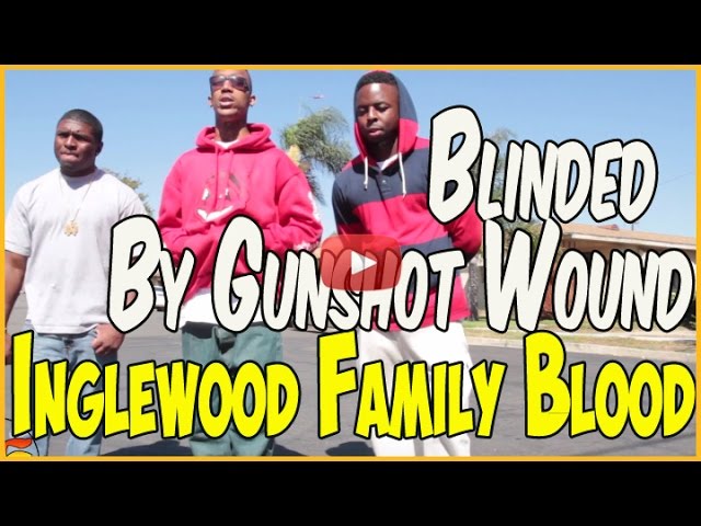 Munchie B from Inglewood Family Bloods lost vision after getting shot in head (pt.1of2)