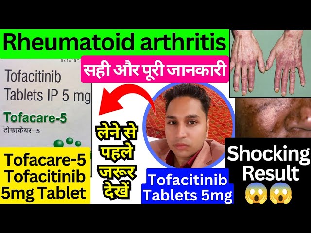 tofacitinib 5 mg tablet hindi | tofacitinib extended release tablets 11 mg | tofacitinib tablets 5mg