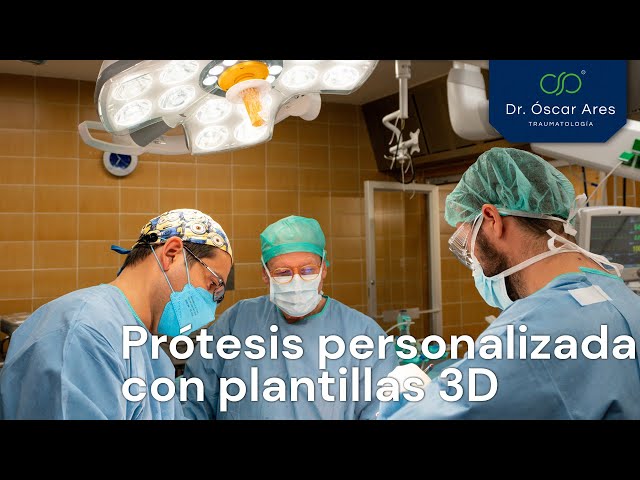 Prótesis personalizada con plantillas 3D - Dr. Oscar Ares