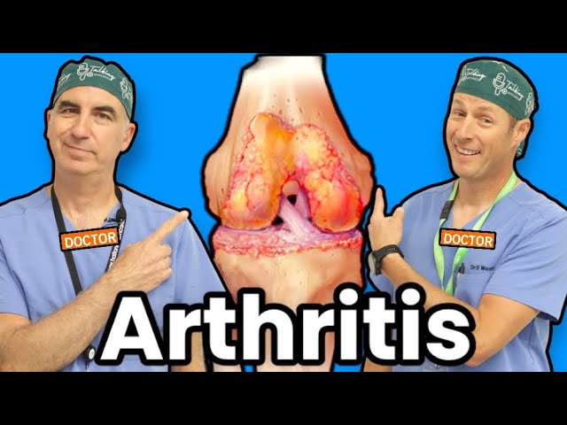 Treating Knee Arthritis Without Surgery