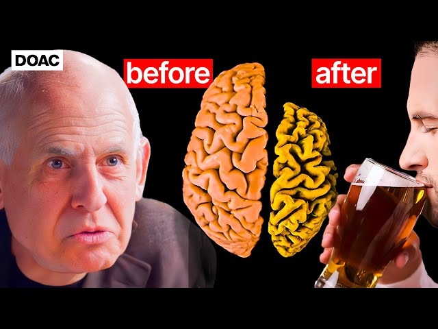 Marijuana & Alcohol Are Destroying Your Brain! No.1 Brain Doctor, Dr Daniel Amen