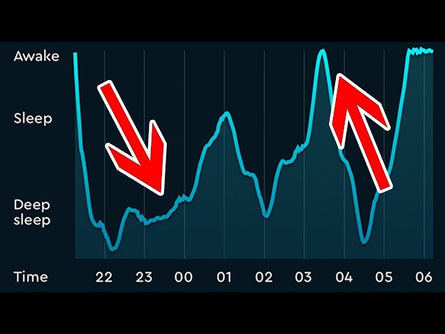 Do dreams occur in light sleep vs deep sleep?