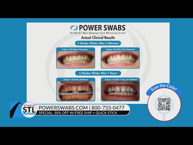 Power Swabs offers 50% off teeth whitening for the New Year!