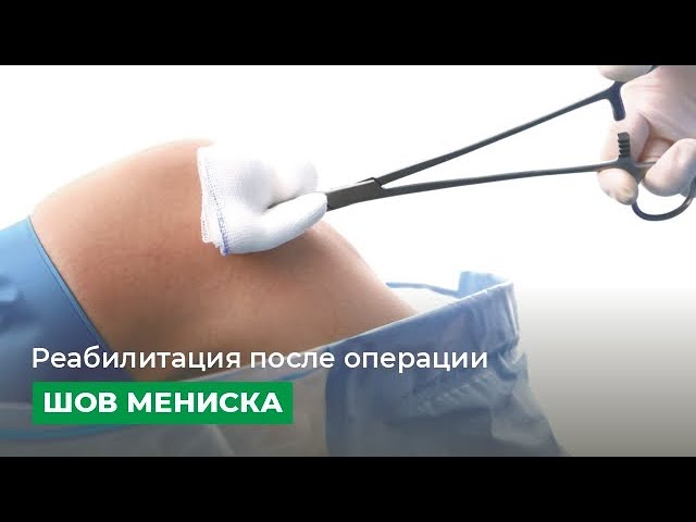 Реабилитация после операции "шов мениска"