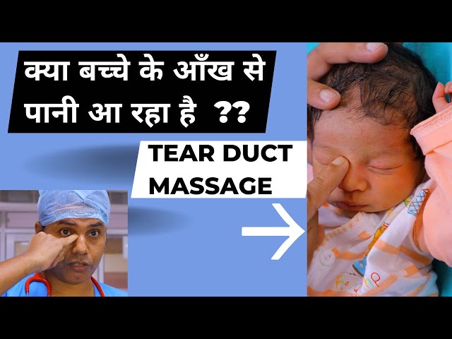 क्या आपके बच्चे की आँखों से पानी आ रहा है? | Sticky eyes | Lacrymal Duct massage