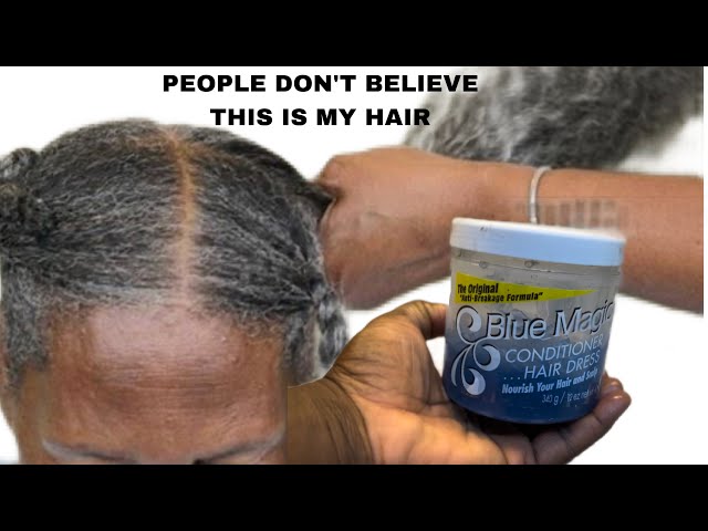 NO JOKE! THIS DIY HAIR GROWTH RECIPE WITH BLUE MAGIC IS BREAKING THE INTERNET! IT WORKS FOR ALL HAIR