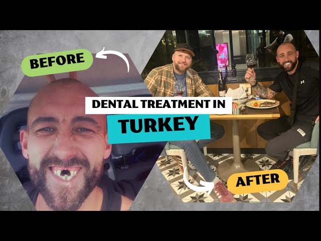 REFORMED GANGSTER gets new teeth and hair fitted in turkey 🇹🇷 PART 1