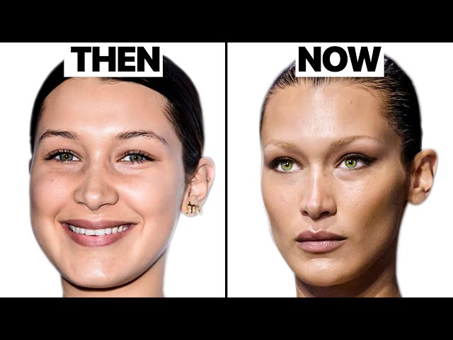 What Happened to Bella Hadid's Face? Plastic Surgeon Reacts