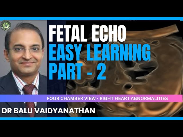 4 CHAMBER VIEW ANOMALIES OF THE RIGHT SIDE | Dr Balu Vaidyanathan #fetalecho2