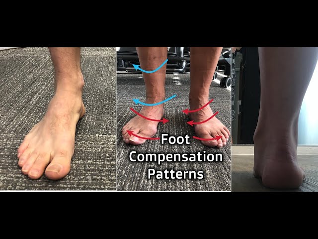 Foot Compensation Patterns