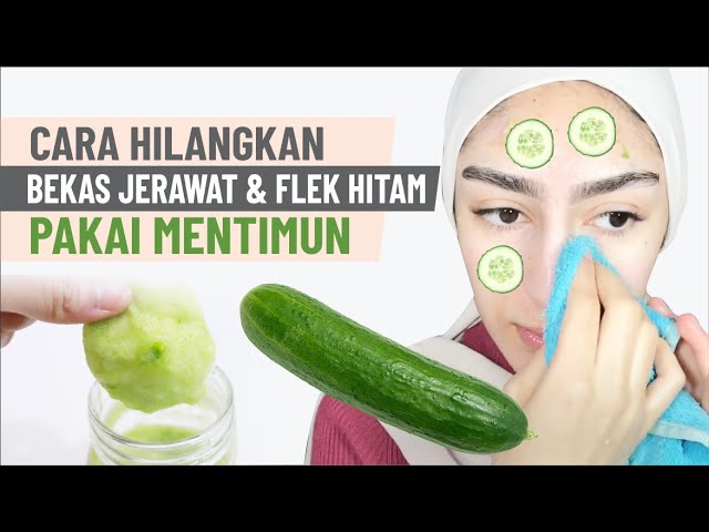 Cara Hilangkan Bekas Jerawat dan flek Hitam di Wajah dengan Mentimun