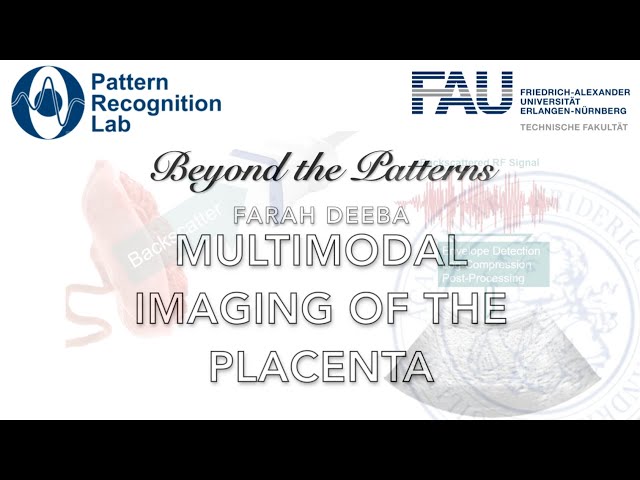 Beyond the Patterns 49 - Farah Deeba – Multimodal Imaging of the Placenta