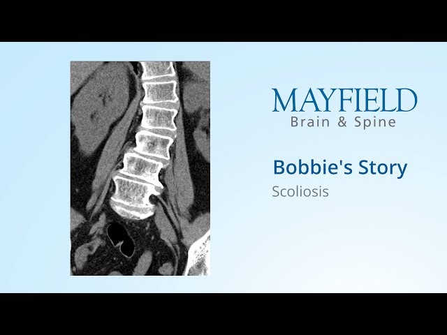 Bobbie's Story: Scoliosis