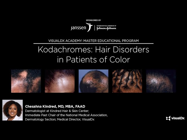 Kodachromes: Hair Disorders in Patients of Color