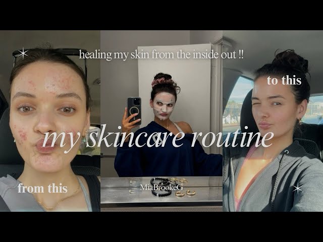 the only video you need to ACTUALLY get clear skin