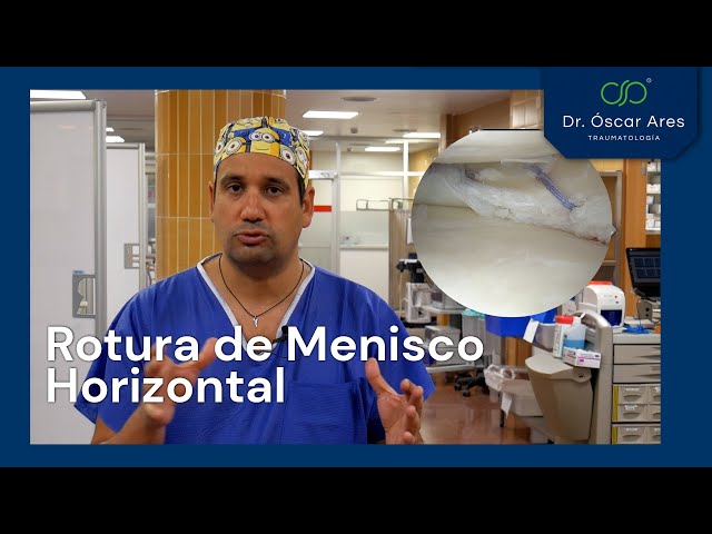 Rotura de Menisco Horizontal - Dr. Oscar Ares