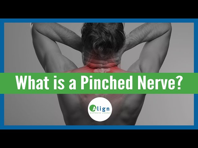 How a Pinched Nerve Happens & What to Do About It