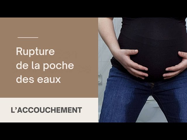 La rupture de la poche des eaux