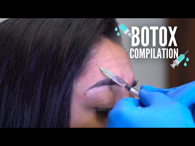 Botox Time Lapse Compilation! 💉😮