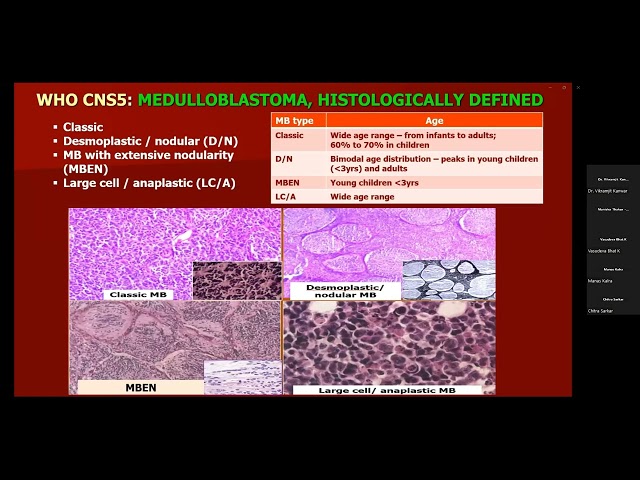 Contemporary Management of Medulloblastoma " The Indian Perspective"