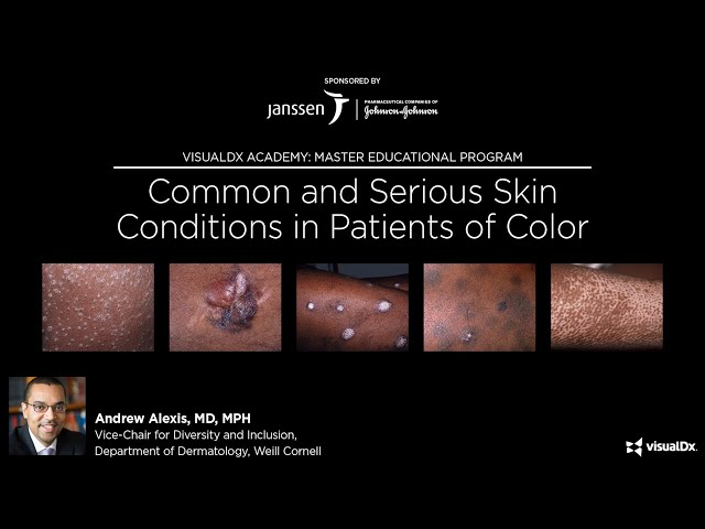 Common and Serious Skin Conditions in Patients of Color