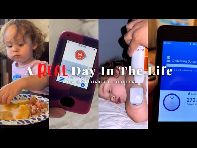 Day In The Life w/ a T1D Toddler #type1diabetes #diabetictoddler