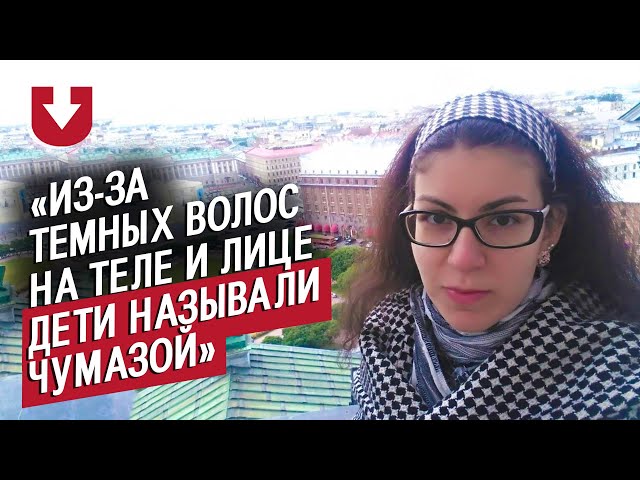 Девушки с гирсутизмом | Неудобные вопросы