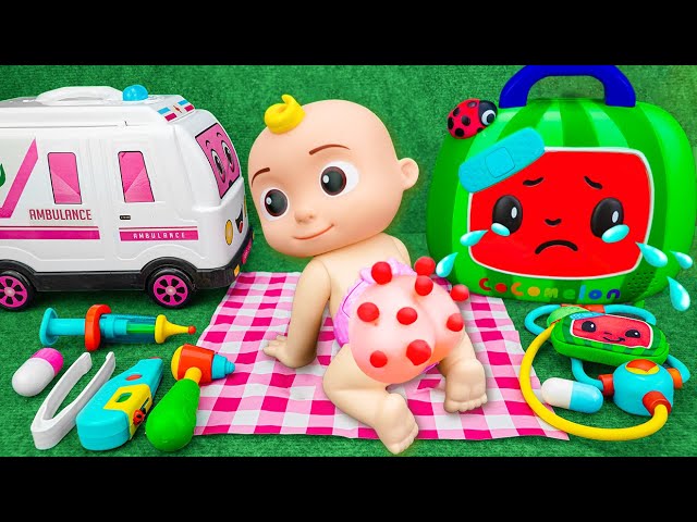 🔴 LIVE 🔴 Doctor Toys Rescue Cocomelon from Butt Acne ASMR | Satisfying Unboxing Ambulance Playset