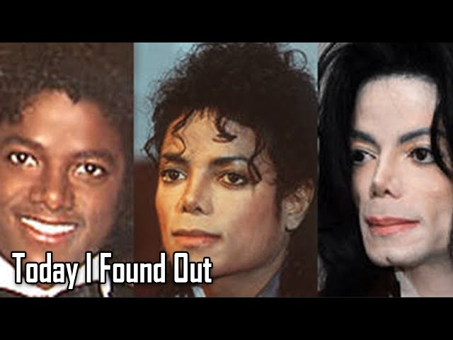 Why Michael Jackson's Skin Turned White as He Got Older